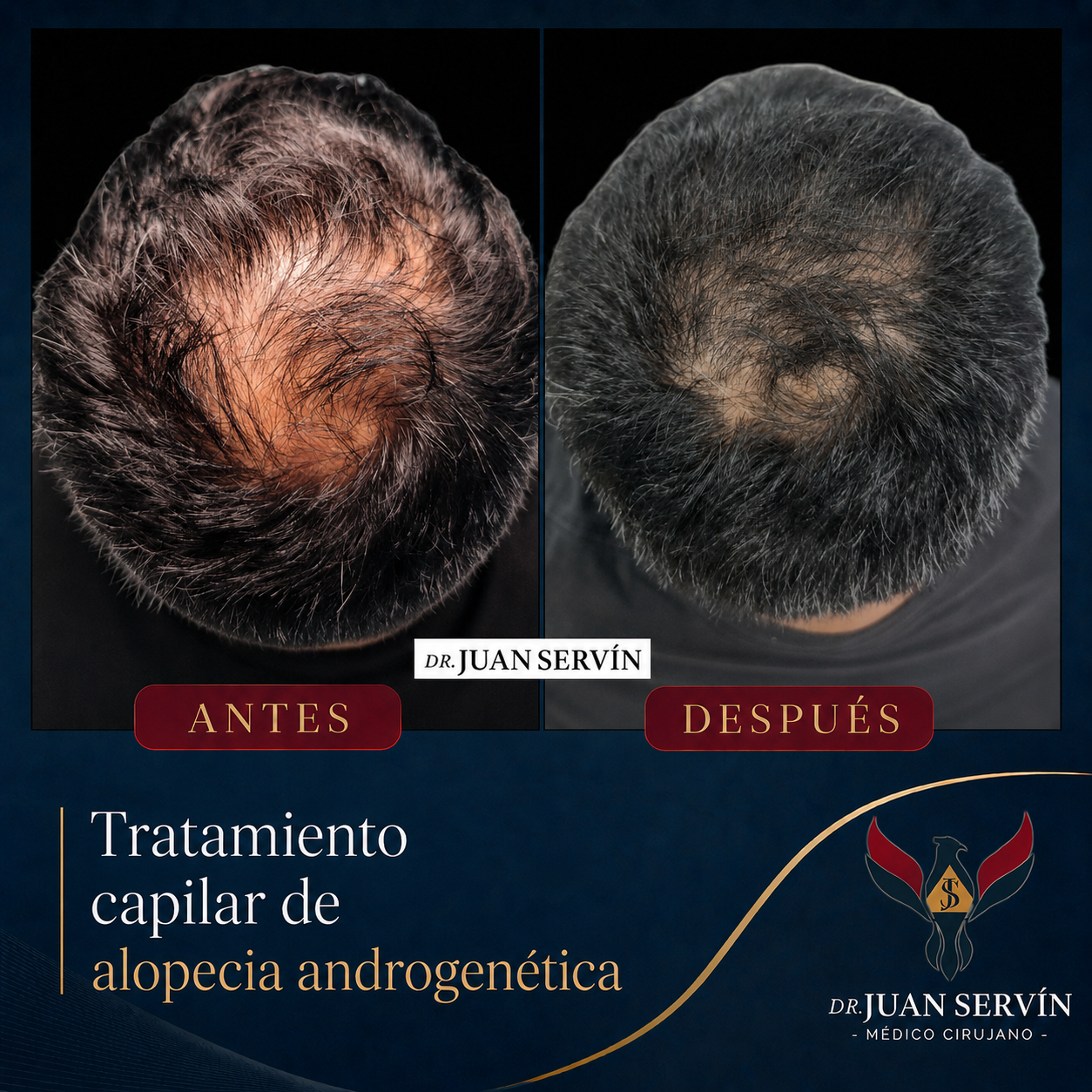Resultado antes y después · caso 3