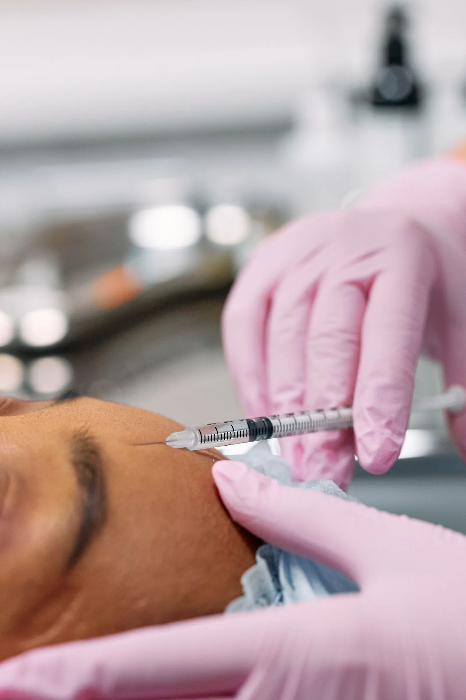 Bótox para arrugas de expresión